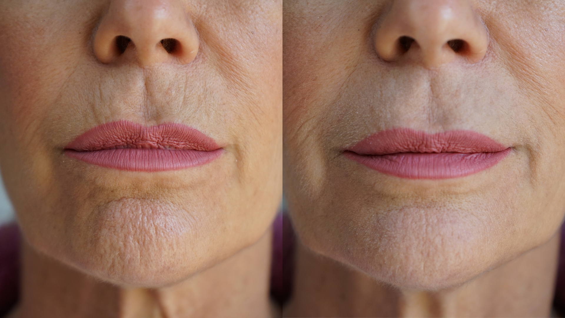 Close-up of Ageless Lip and Line Filler with pointed applicator tip against a clean neutral background