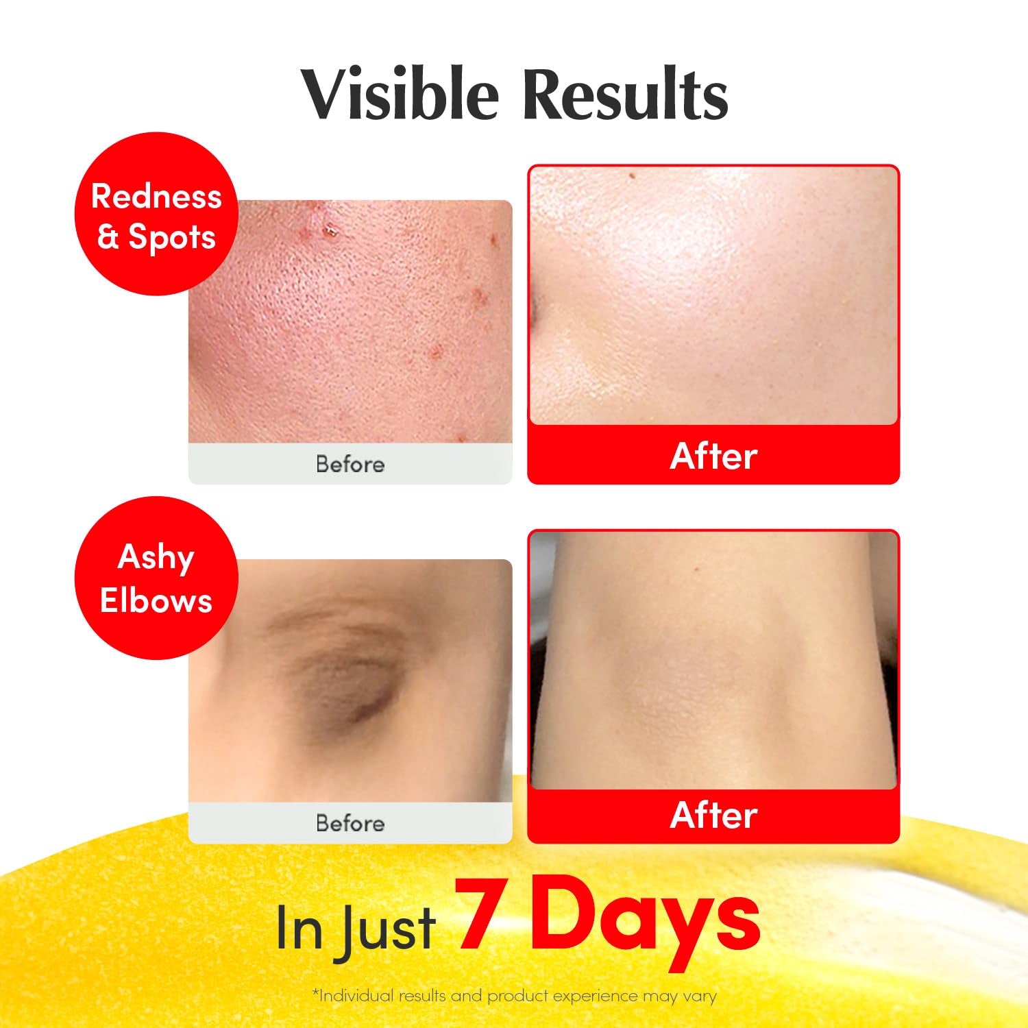 EQQUALBERRY Vitamin Illuminating Serum | Niacinamide 4% + Brightening Vitamin C Face Serum with Hyaluronic Acid & Vitamin E | Dark Spot, Uneven Tone Care | Korean Skincare, 1.01 Fl.Oz