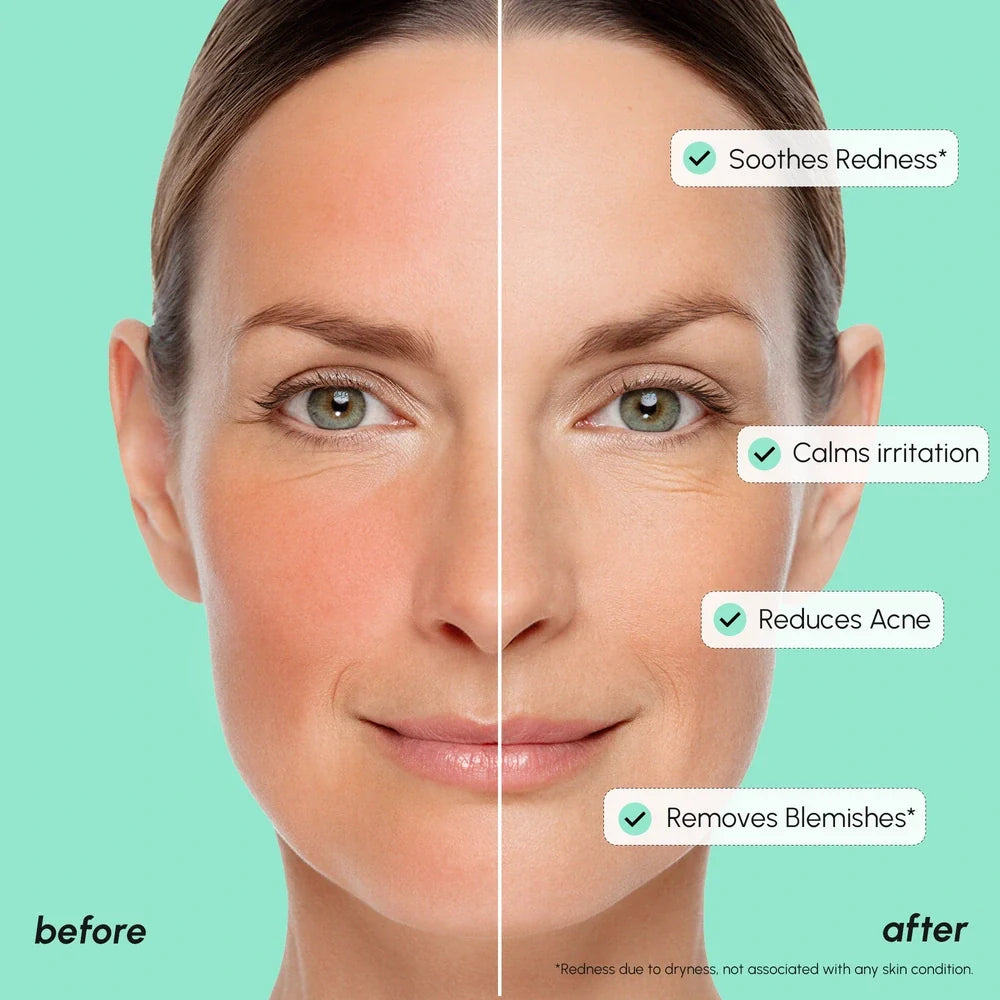 Marée azelaic acid serum bottle against a clean neutral background, a lightweight redness-soothing treatment for sensitive skin