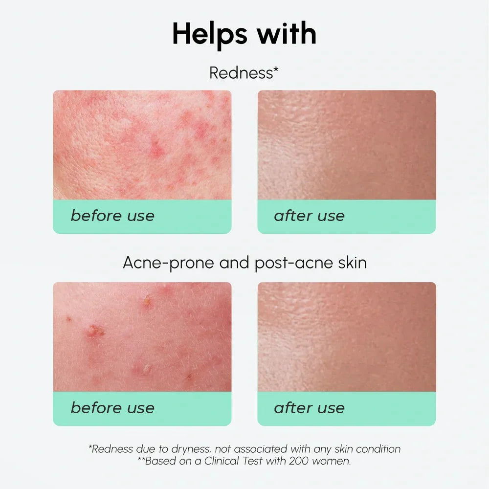 Marée azelaic acid serum bottle against a clean neutral background, a lightweight redness-soothing treatment for sensitive skin