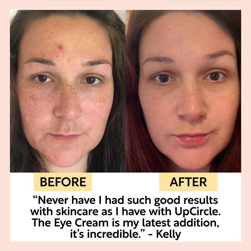 UpCircle eye cream in a glass jar with aluminium lid, showing coffee oil and hyaluronic acid formula for dark circles