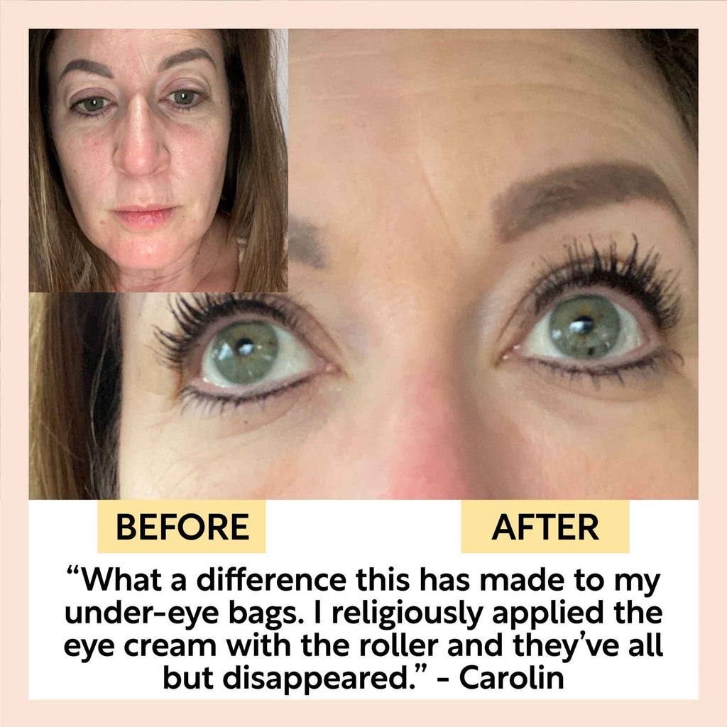 UpCircle eye cream in a glass jar with aluminium lid, showing coffee oil and hyaluronic acid formula for dark circles