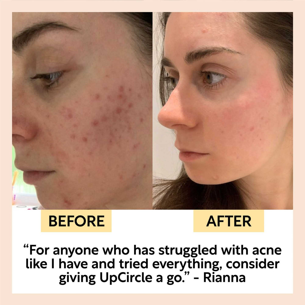 UpCircle Hyaluronic Acid and Chamomile Face Toner in a glass spray bottle with cardboard packaging on a clean surface