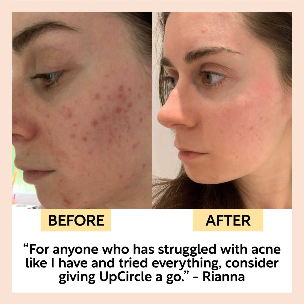 UpCircle Hyaluronic Acid and Chamomile Face Toner in a glass spray bottle with cardboard packaging on a clean surface