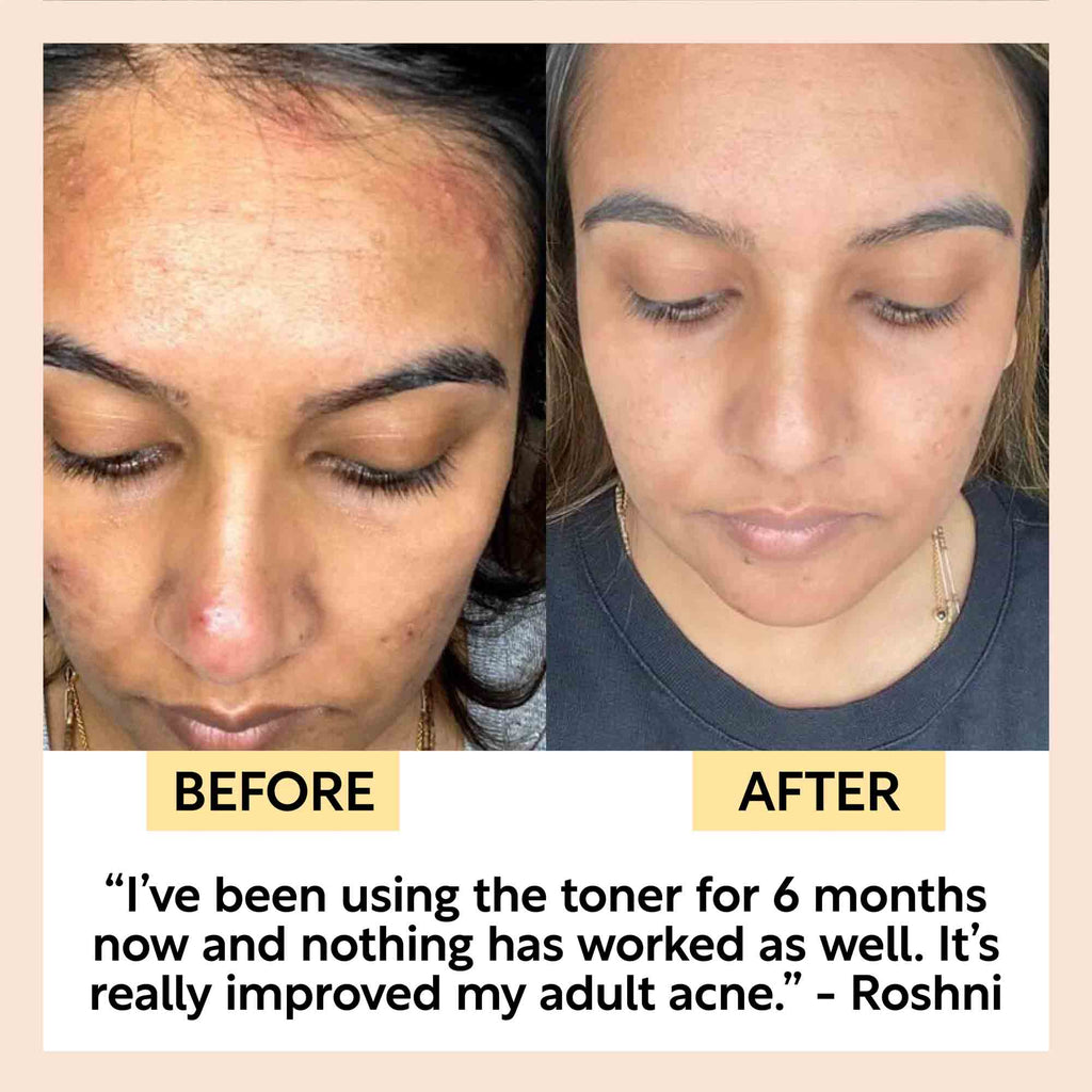 UpCircle Hyaluronic Acid and Chamomile Face Toner in a glass spray bottle with cardboard packaging on a clean surface