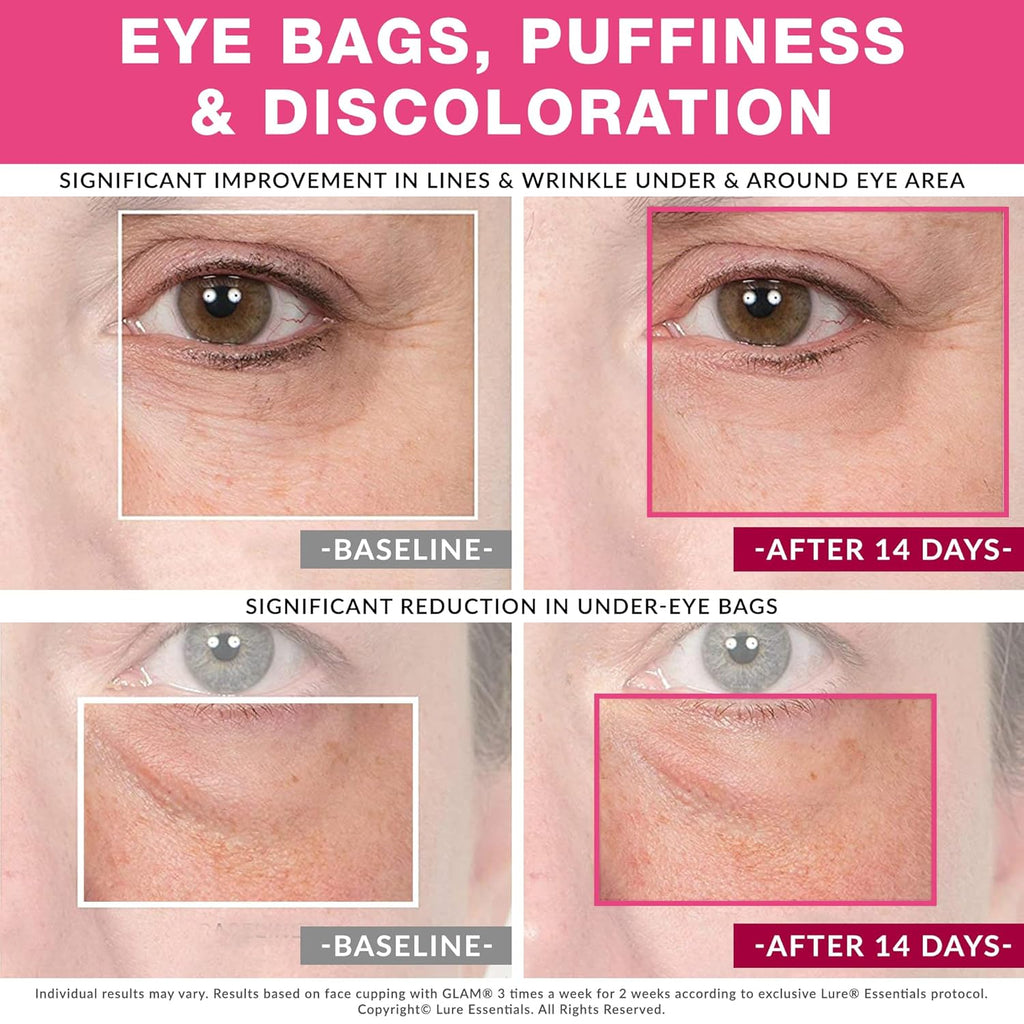 Lure Essentials GLAM facial cupping set with cups sized for the face, eyes and lips