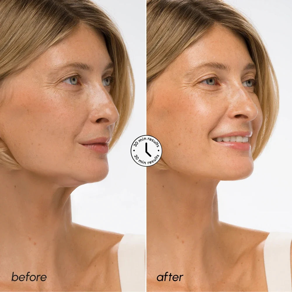 Model wearing a white V-line chin and neck lifting sheet mask, front-facing close-up showing fit and coverage