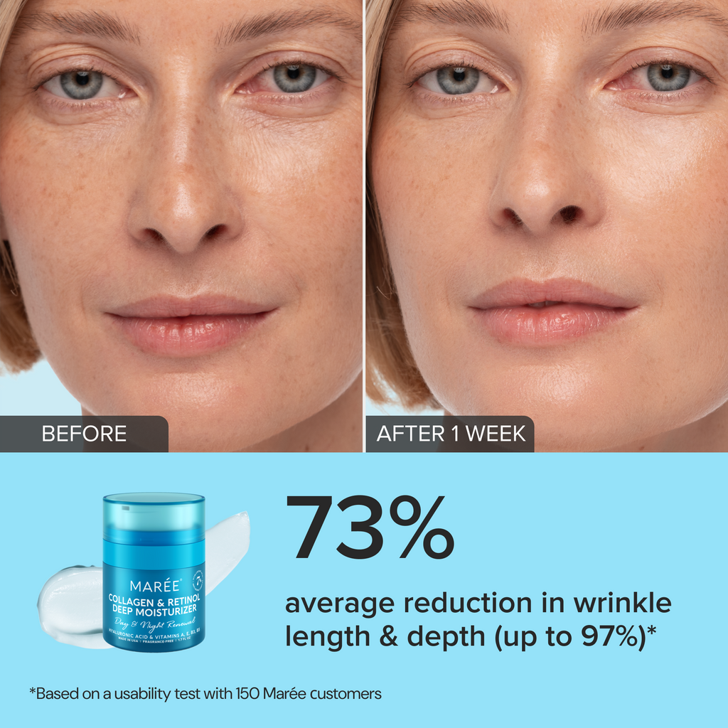 Retinol and collagen anti-aging face cream jar on a clean white surface, front-facing product shot