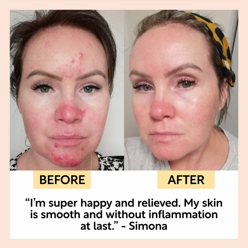 UpCircle Night Cream in glass jar with aluminum lid, showing hyaluronic acid and niacinamide overnight moisturizer