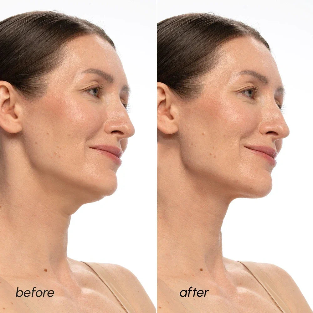 Marée PDRN V-Line Lifting Mask applied to chin and neck area for jawline contouring and skin firming