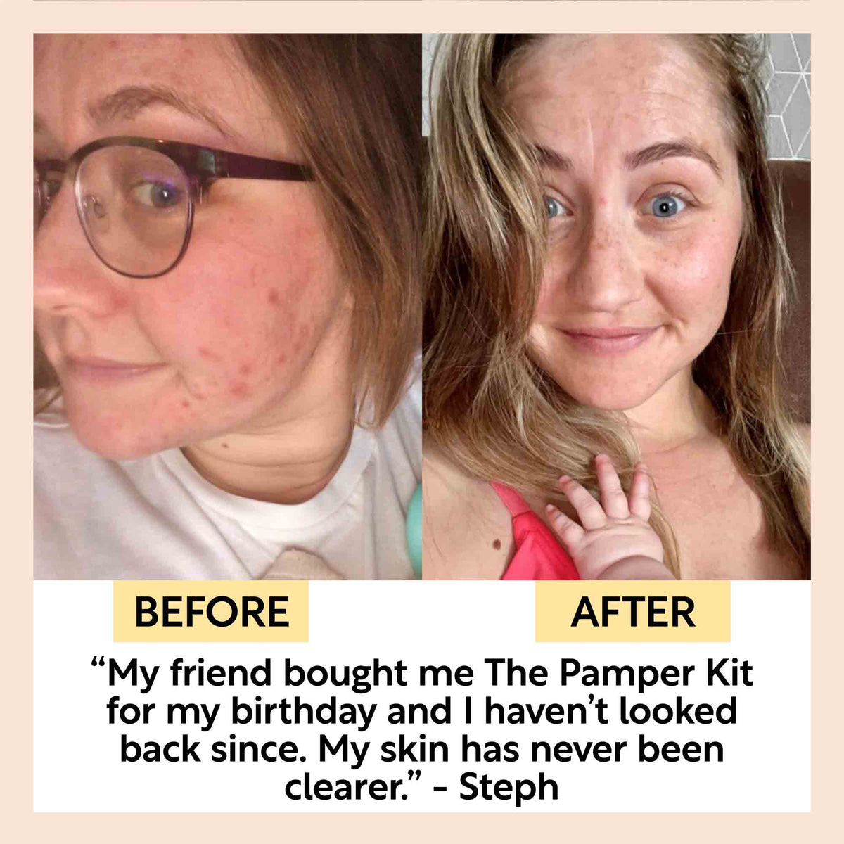 UpCircle Pamper + Gift skincare kit with sample-size face and hair care products and a $20 gift card