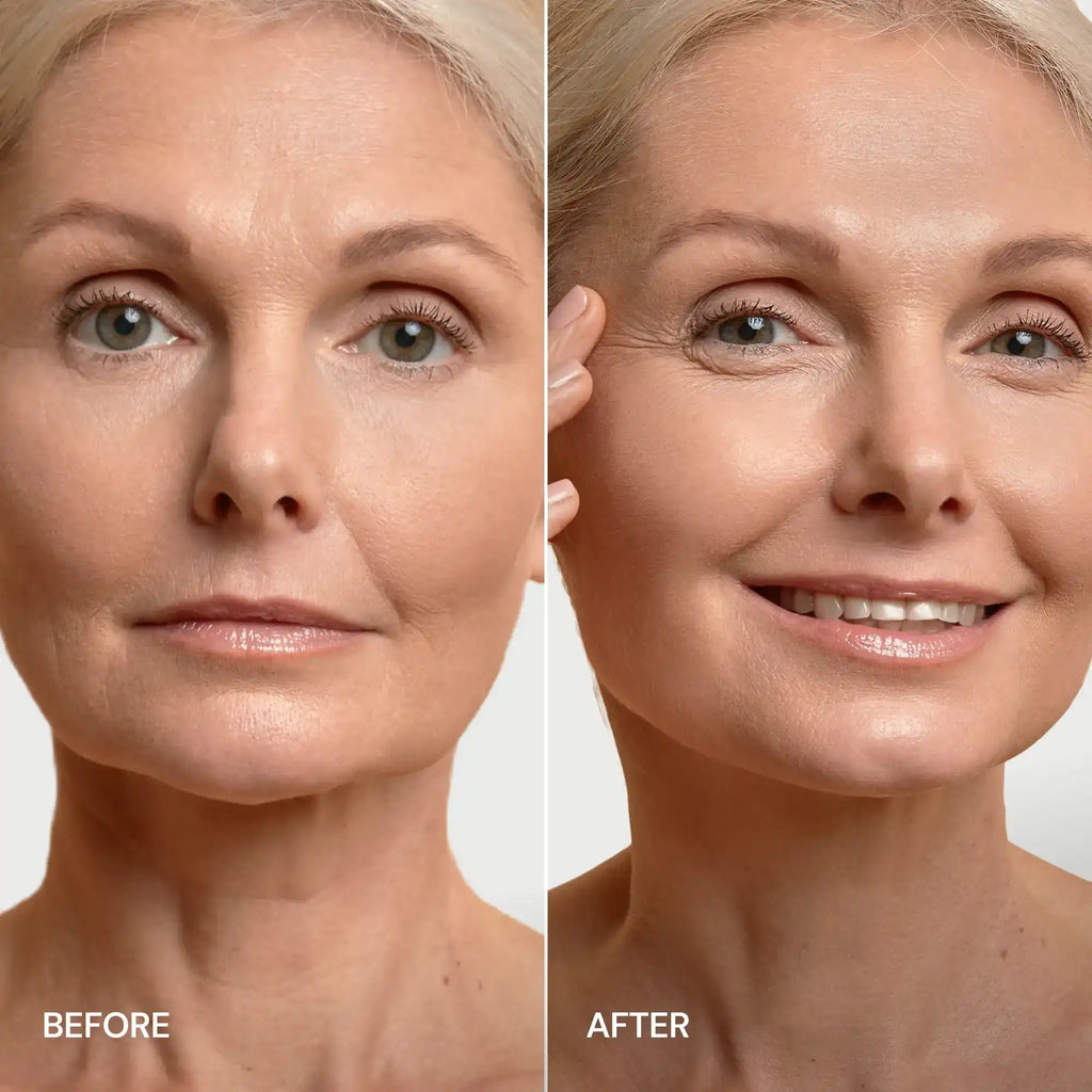 24K gold v-line hydrogel lifting mask displayed flat, showing contoured chin and neck coverage shape