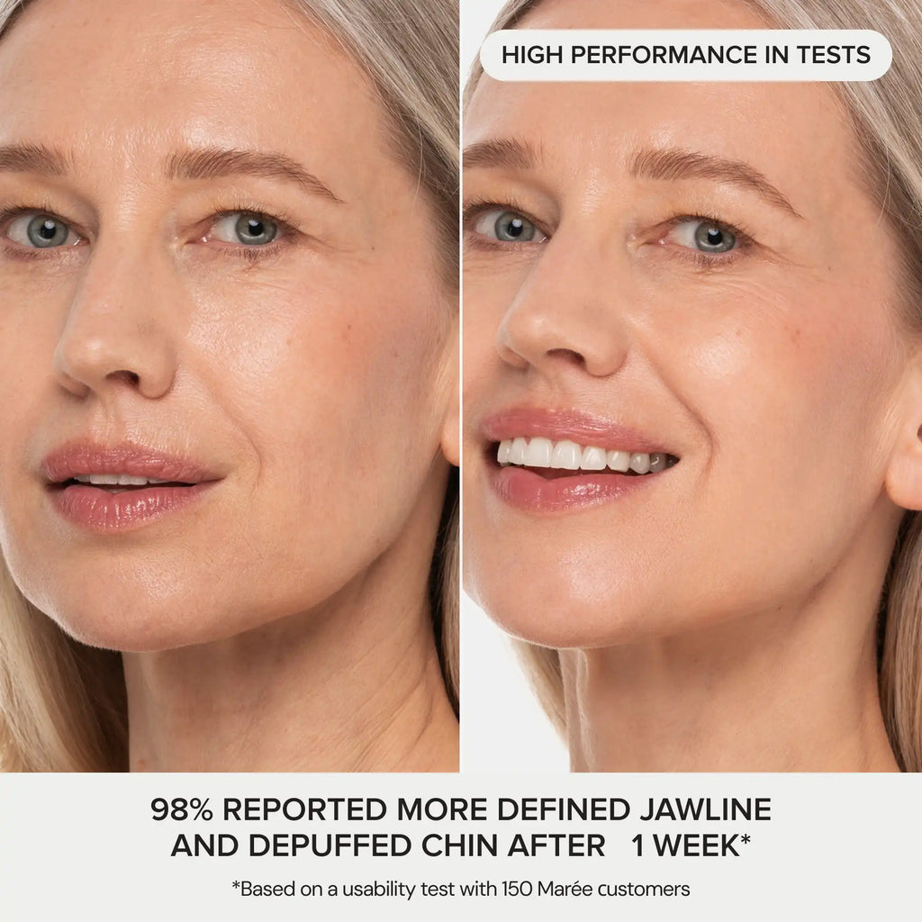 24K gold v-line hydrogel lifting mask displayed flat, showing contoured chin and neck coverage shape