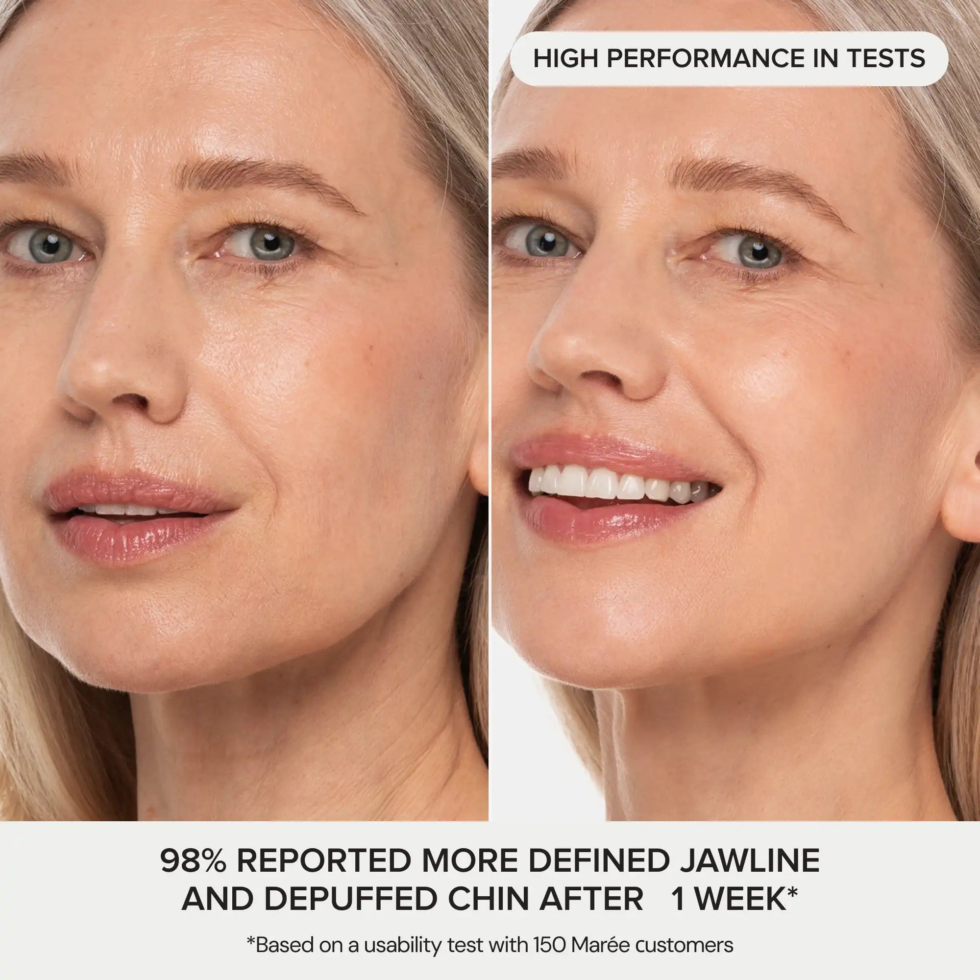 24K gold v-line hydrogel lifting mask displayed flat, showing contoured chin and neck coverage shape